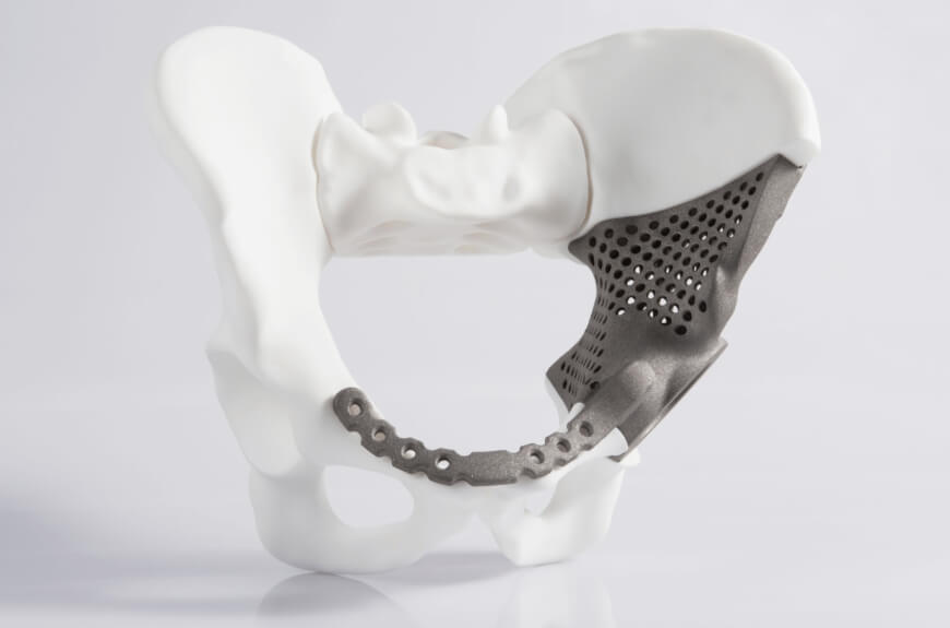 The Ultimate List of What We Can 3D Print in Medicine And Healthcare ... - 3D PrinteD Hip