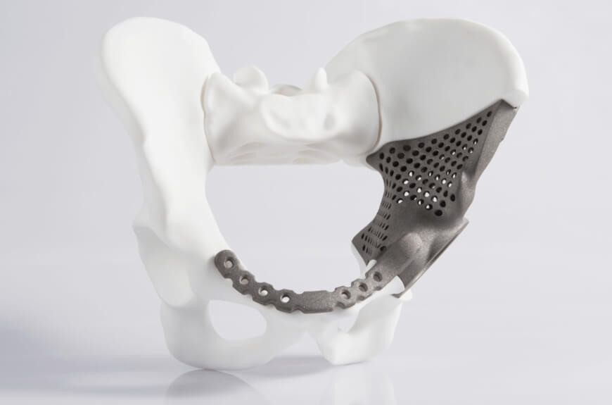 The Ultimate List Of What We Can 3d Print In Medicine And Healthcare The Medical Futurist