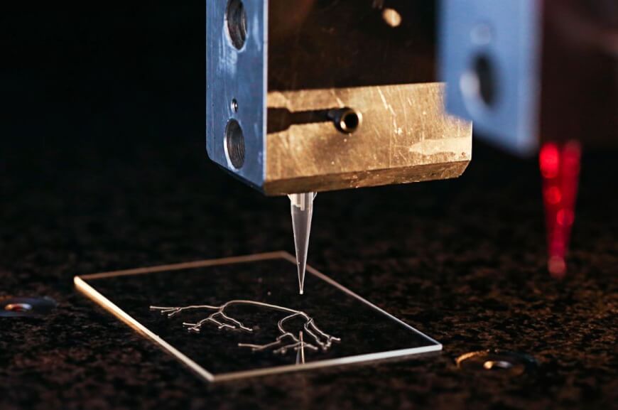 3D Printing In Health Sector  : 3D Printing�s Contribution To Orthodontics Is Enormously Huge.