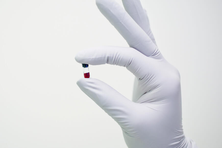 Why Theranos Will Decide The Future of Medical Innovation