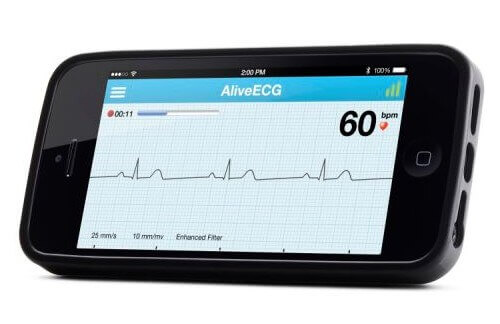 health sensor alivecor records EKG