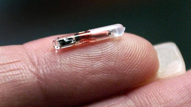Implanted Chips - Why people should not fear digital health technology?