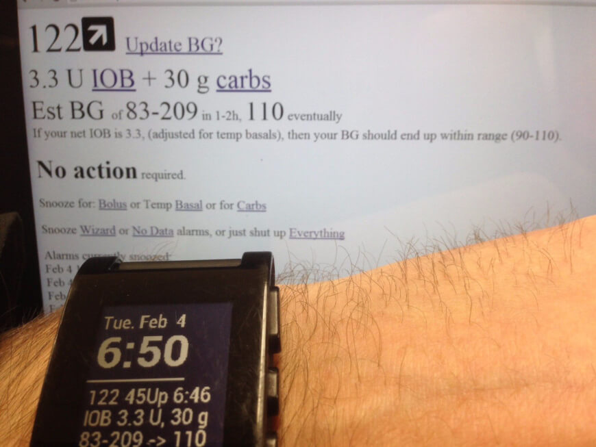 Hacked Raspberry Pi turned into artificial pancreas