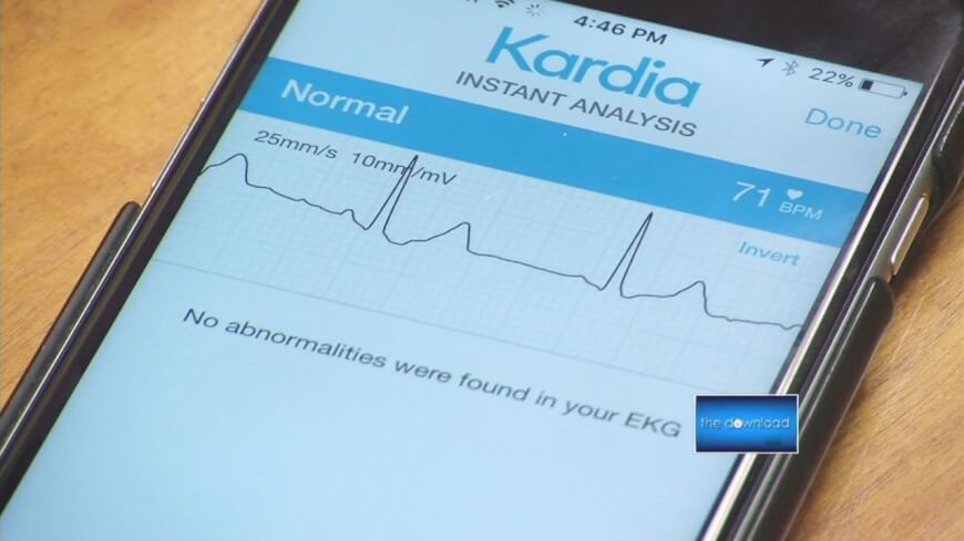 https://1712507217.rsc.cdn77.org/wp-content/uploads/2017/04/alivecor-kardia-review.jpeg