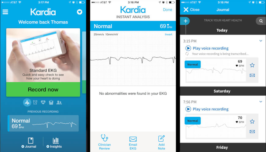 The KardiaMobile Card Review: Accurate ECG Recording and Analysis