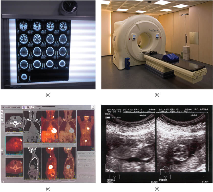 The Future Of Radiology And Artificial Intelligence The