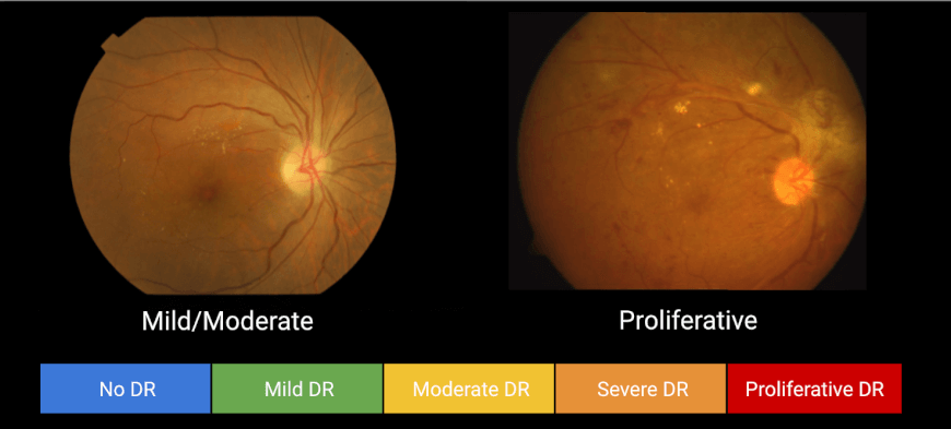 Future of Vision