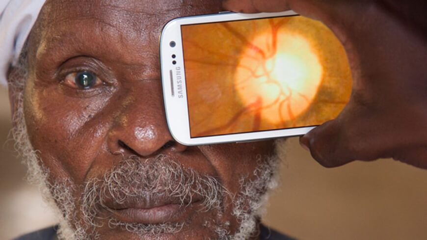 Future of Vision