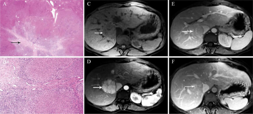 future of pathology