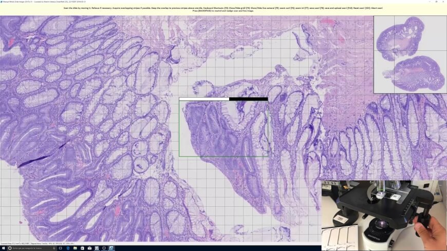 future of pathology