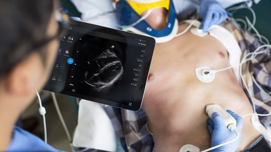 portable ultrasound review