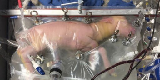 artificial womb