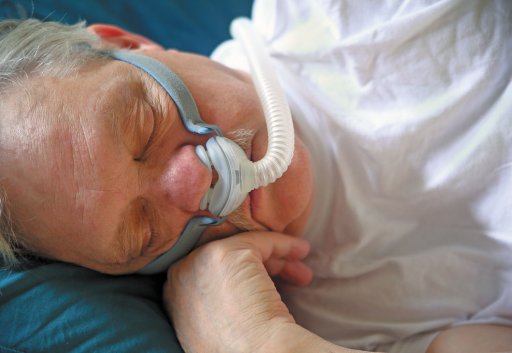 sleep apnea treatment