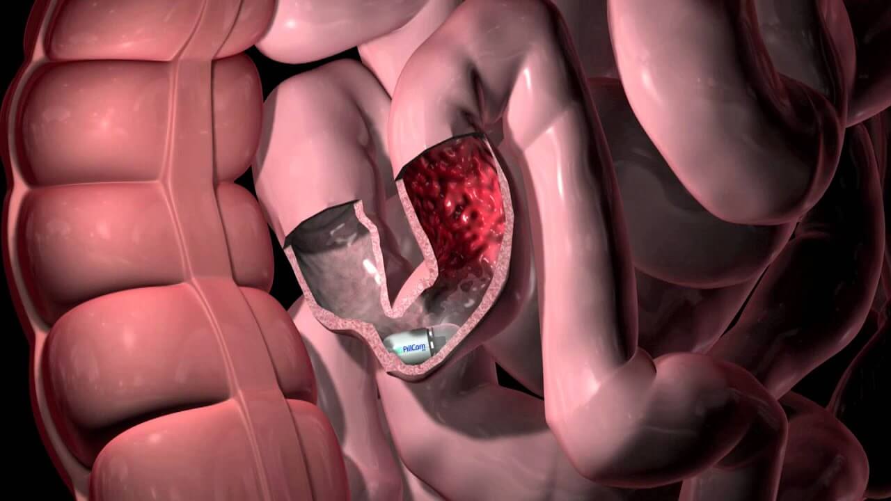 future of gastroenterology